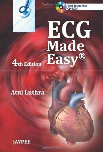 ECG Made Easy 