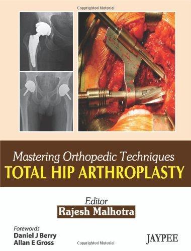 Total Hip Arthroplasty (Mastering Orthopedic Techniques) 