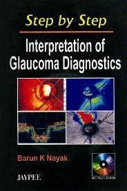 Step by Step Interpretation of Glaucoma Diagnostics with CD-ROM