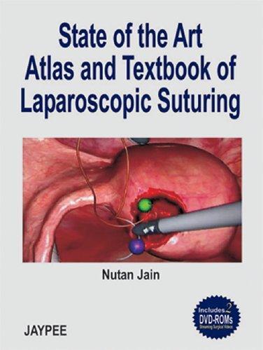 STATE OF THE ART ATLAS & TB OF LAPAROSCOPIC SUTURING INCLUDES 2 DVD-ROM : 2006