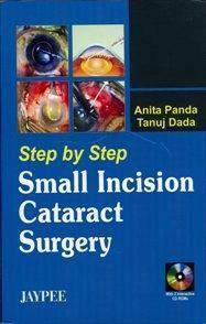 STEP BY STEP SMALL INCISION CATARACT SURGERY 2 INT.CD ROM : 2006