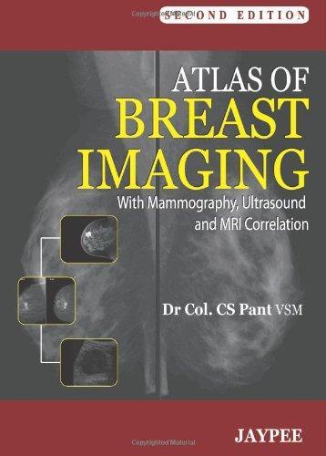 Atlas of Breast Imaging