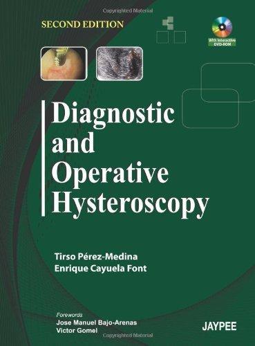 Diagnostic and Operative Hysteroscopy