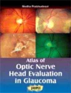 ATLAS OF OPTIC NERVE HEAD EVALUATION IN GLAUCOMA:2006(R)