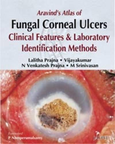 ARAVIND'S ATLAS OF FUNGAL CORNEAL ULCERS CLINICAL FEATURES & LAB.IDENTIFICATION METHODS,2008