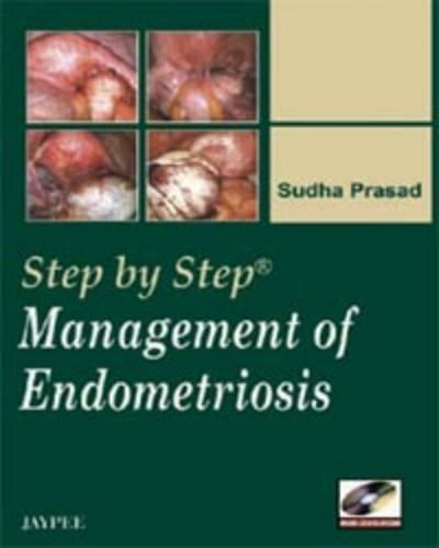 Management of Endometriosis (Step By Step)