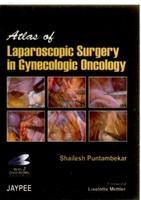 Atlas of Laparoscopic Surgery in Gynecologic Oncology with 2 DVD-ROMs