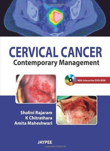 Cervical Cancer: Contemporary Management (With DVD-ROM)