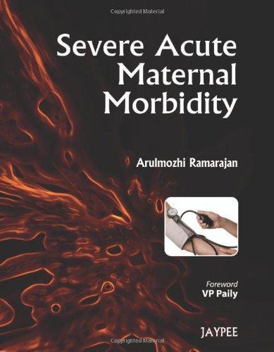 Severe Acute Maternal Morbidity