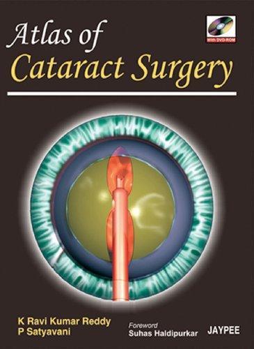 ATLAS OF CATARACT SURGERY WITH DVD ROM:2008(R)