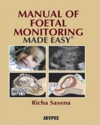 Manual Of Fetal Monitoring Made Easy