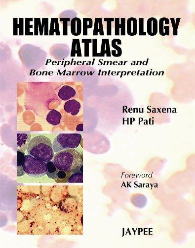 Hematopathology (Rp) Atlas Peripheral Smear And Bone Marrow Interpretation,2008