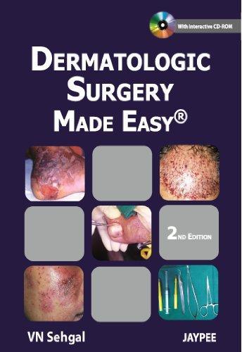 Dermatologic Surgery Made Easy
