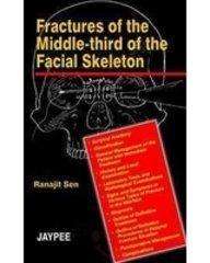 FRACTURES OF THE MIDDLE-THIRD OF THE FACIAL SKELETON, 2003