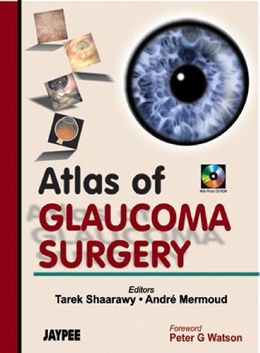 ATLAS OF GLAUCOMA SURGERY WITH PHOTO CD-ROM.2006