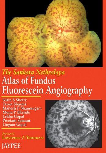 THE SANKARA NETHRALAYA ATLAS OF FUNDUS FLUORESCEIN ANGIOGRAPHY:2004(R)