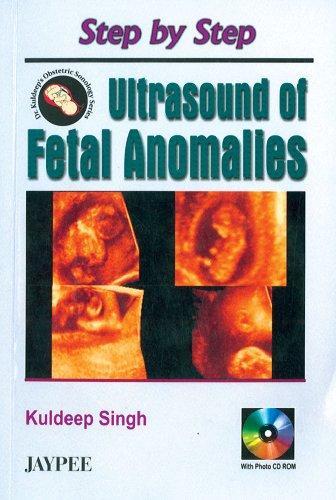 STEP BY STEP ULTRASOUND OF FETAL ANOMALIES WITH PHOTO CD ROM, 2006