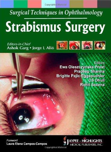 Surgical Techniques in Opthalmology: Strabismus Surgery (Surgical Techniques in Ophthalmology) 