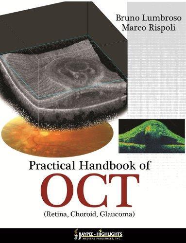 Practical Handbook of Oct: Retina, Choroid, Glaucoma 