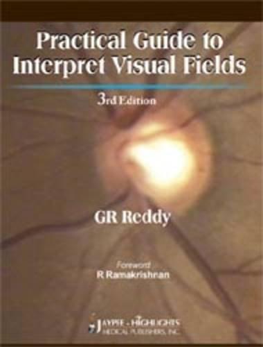 Practical Guide to Interpret Visual Fields