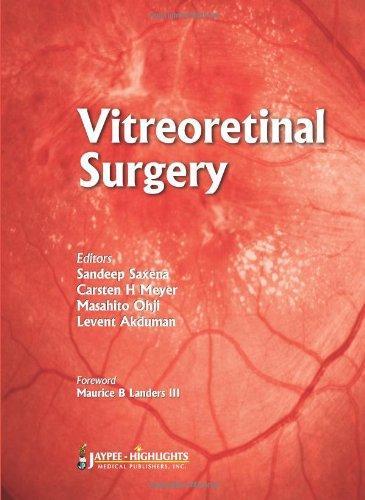 Vitreoretinal Surgery