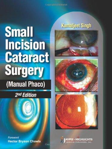 Small Incision Cataract Surgery: Manual Phaco 