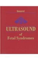 Ultrasound of Fetal Syndromes, 1e