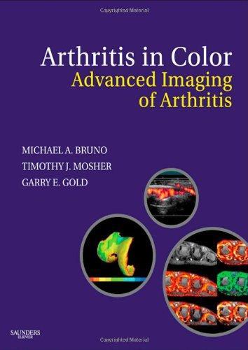 Arthritis in Color: Advanced Imaging of Arthritis, 1e 