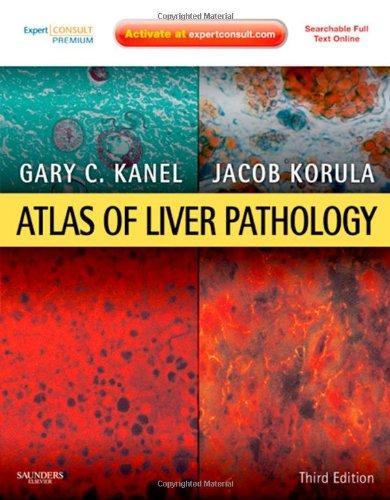 Atlas of Liver Pathology : Expert Consult - Online and Print