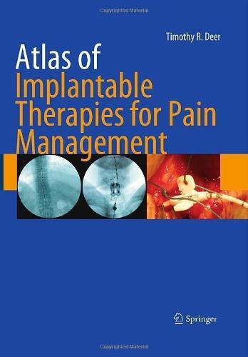 Atlas of Implantable Therapies for Pain Management