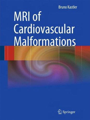 MRI of Cardiovascular Malformations