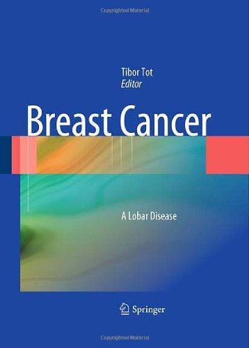 Breast Cancer: A Lobar Disease