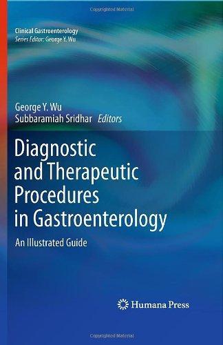 Diagnostic and Therapeutic Procedures in Gastroenterology: An Illustrated Guide