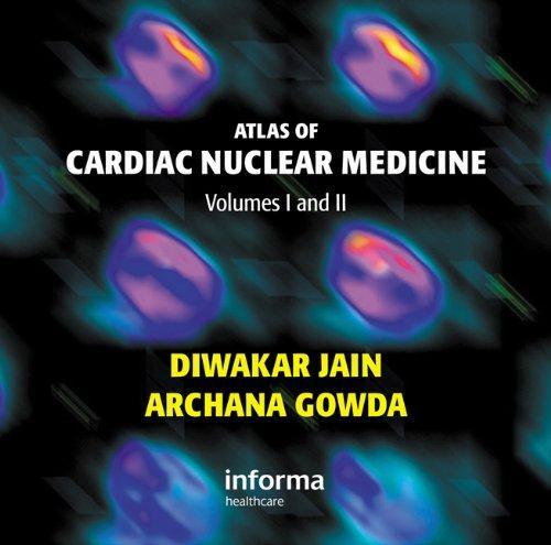 Atlas of Cardiac Nuclear Medicine