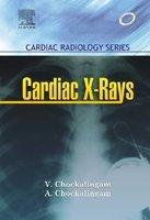 Cardiac X-Rays – Cardiac Radiology Series