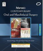 Contemporary Oral and Maxillofacial Surgery