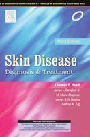 Skin Disease: Diagnosis and Treatment