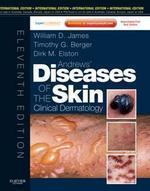 Andrews\' Diseases of the Skin, International Edition With Expert Consult – Online and Print