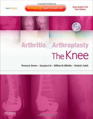 Arthritis and Arthroplasty: The Knee: Expert Consult - Online, Print and DVD, 1e