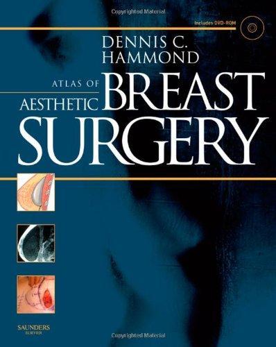 Atlas of Aesthetic Breast Surgery, 1e 