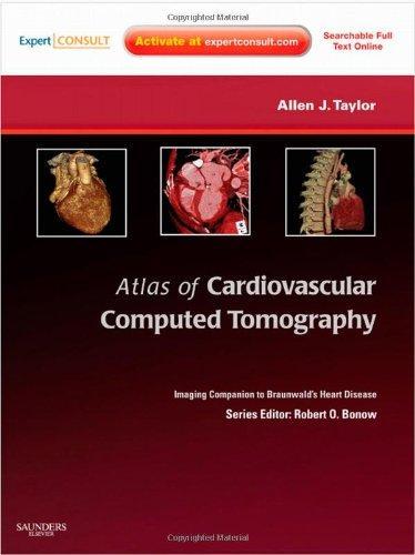 Atlas of Cardiovascular Computed Tomography: An Imaging Companion to Braunwald's Heart Disease [With Access Code]