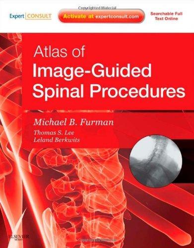 Atlas of Image-Guided Spinal Procedures: Expert Consult - Online and Print, 1e