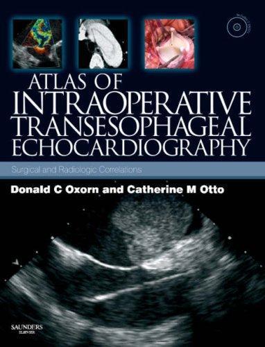 Atlas of Intraoperative Transesophageal  Echocardiography: Surgical and Radiologic Correlations, Text with DVD, 1e 