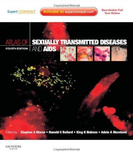 Atlas of Sexually Transmitted Diseases and AIDS [With Access Code]