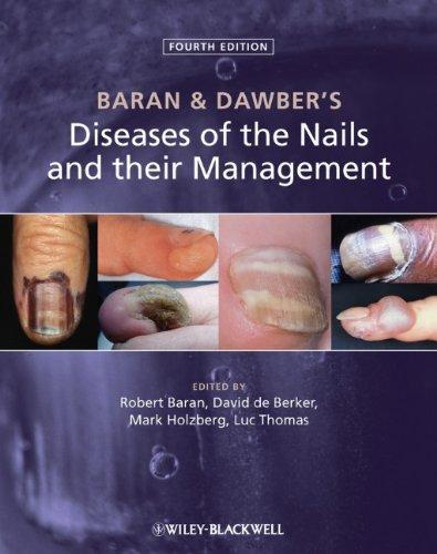 Baran and Dawber's Diseases of the Nails and their Management 