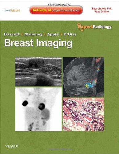 Breast Imaging: Expert Radiology series Expert Consult- Online and Print, 1e 