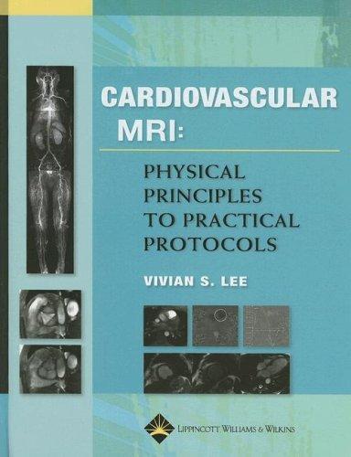 Cardiovascular MRI: Physical Principles to Practical Protocols