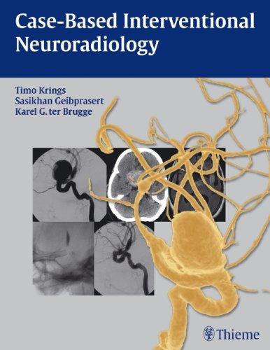 Case-Based Interventional Neuroradiology