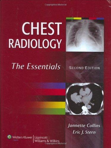 Chest Radiology: The Essentials 