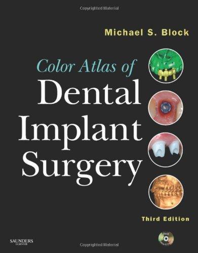 Color Atlas of Dental Implant Surgery [With DVD]